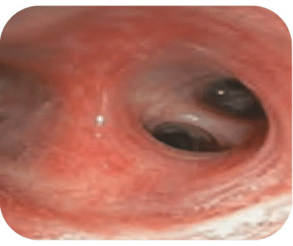 endoscopy-carousel-img-7