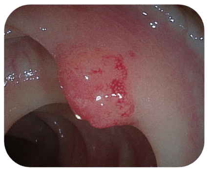 endoscopy-carousel-img-8